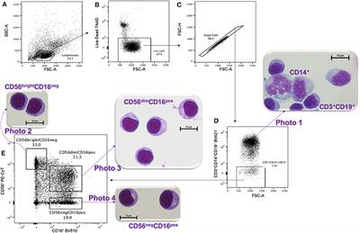 A New Hope for CD56negCD16pos NK Cells as Unconventional Cytotoxic Mediators: An Adaptation to Chronic Diseases